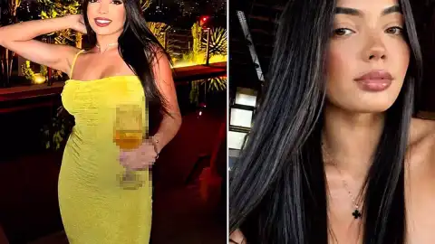 Brezilya'da Estetik Operasyonda Genç Kadın Hayatını Kaybetti