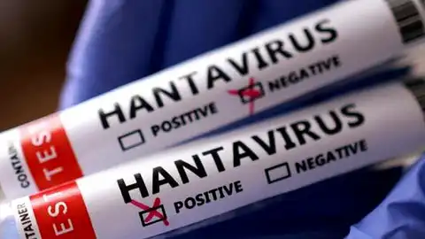 Hantavirüs Endişesi: Arjantin'den Gelen 3 Türk Vatandaşı Karantinaya Alındı