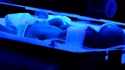 İstanbul'da Hastanede Bebek Kuvözde Yandı: 3. Derece Yanık Oluştu