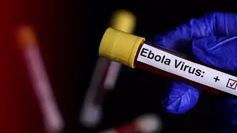 Uganda, Ebola Salgını Nedeniyle Kongo Demokratik Cumhuriyeti Sınırını Kapattı