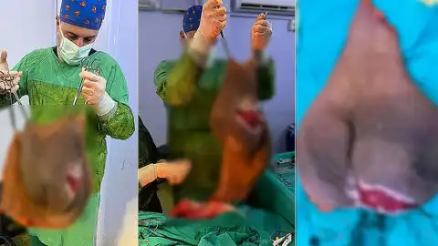 Aydın'da Leyla Demirkafa'nın Karnından 40 Kilogramlık Kitle Çıkarıldı