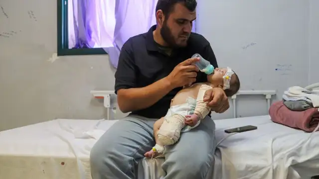 İsrail Saldırısında Annesini Kaybeden Bebek Muhammed'in Bacağı Ampute Edildi