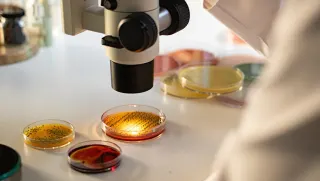 Pitbull Saldırısı Sonrası O.A. Yoğun Bakımda: 'Et Yiyen Bakteri' Şüphesi