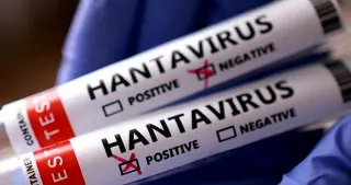 Hantavirüs Endişesi: Arjantin'den Gelen 3 Türk Vatandaşı Karantinaya Alındı