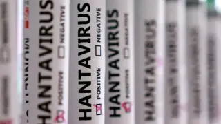 MV Hondius Gemisinde Hantavirüs Salgını: 3 Kişi Hayatını Kaybetti, Kayıp Numuneler Şüphe Çekti