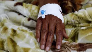 Nijerya'da Lassa Ateşi Can Kaybı 190'a Yükseldi